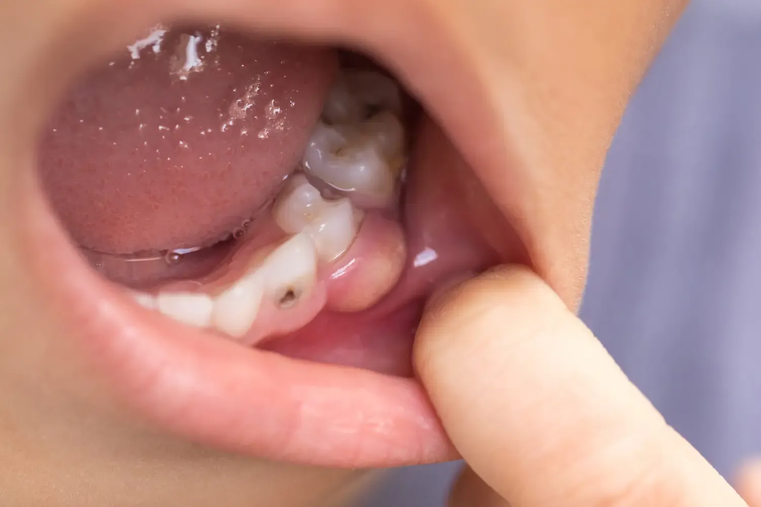 "Je ne donnerais plus jamais ça à mes enfants" : l'alerte massive des dentistes sur deux aliments